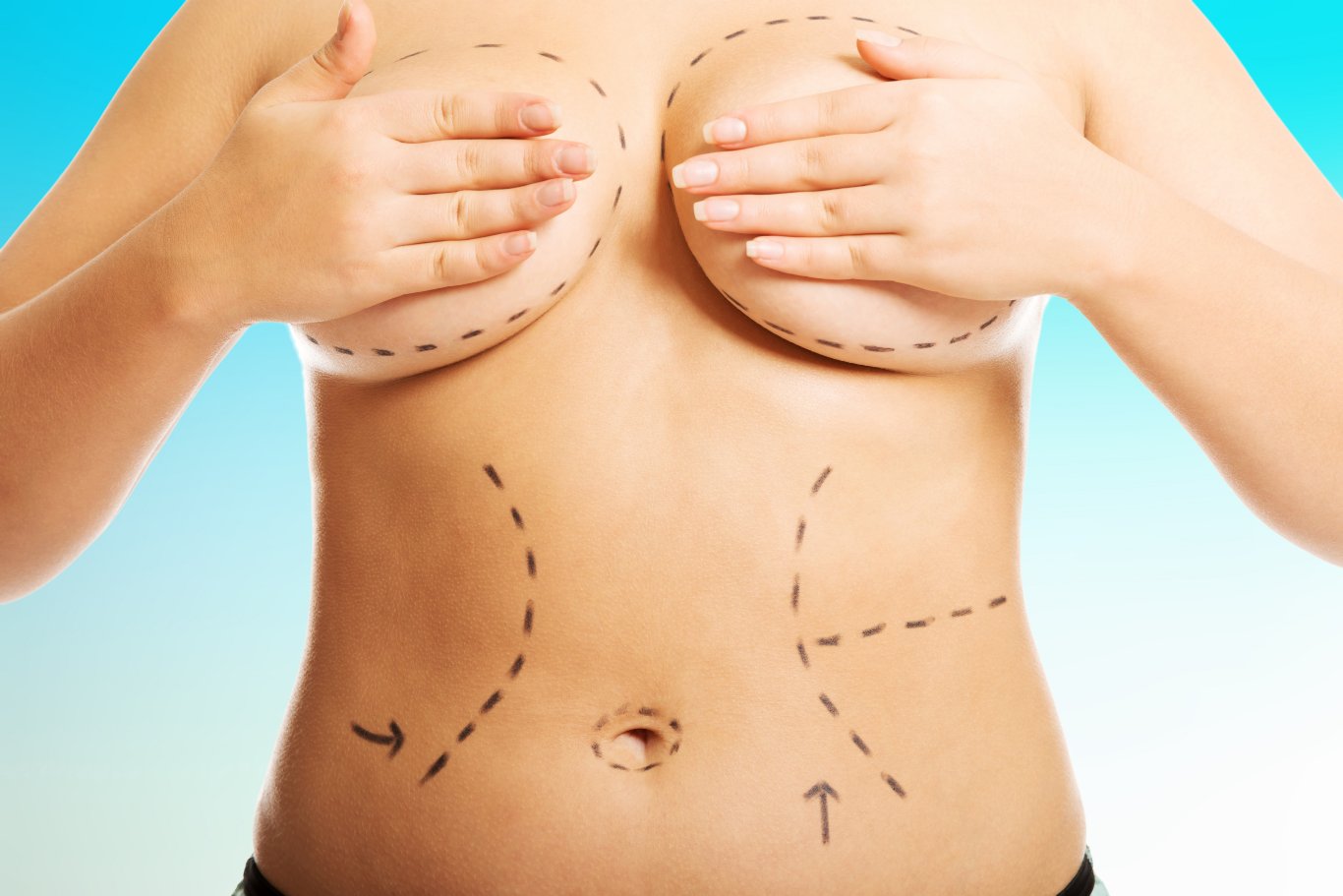 Best Breast Lift with Implants Las Vegas & Henderson
