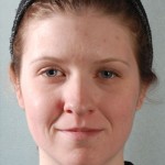 otoplasty-pt1-after-front-150x150